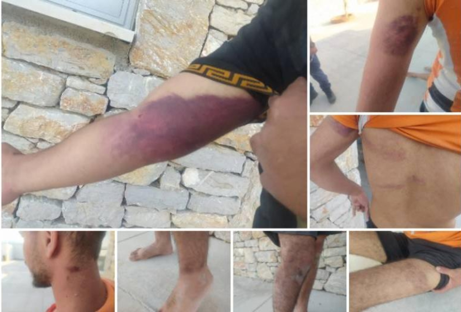Καταγγελία για βασανισμό προσφύγων στο Φαρμακονήσι από την Aegean Boat Report